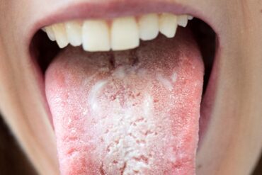 BORAKS (czteroboran sodu)